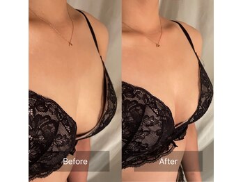 ハートランド(HEARTLAND)/プチ・クレオパトラ☆1回の施術