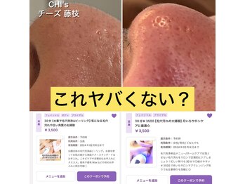 チーズ(CHI’S)/毛穴汚れNo. 1は断トツ鼻です！