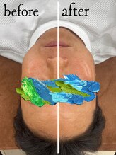 4515/お客様Before After