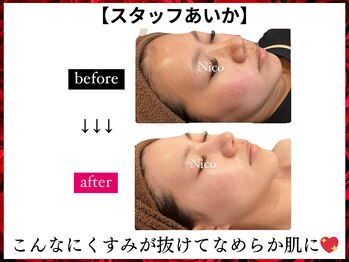 ニコ 岐南本店(Nico)/陶肌★Before→after