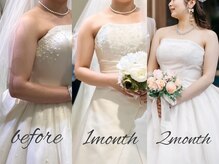 アモリール(Amolir)の雰囲気（結果に差が出る独自の【ブライダル痩身】でドレス映え美ボディに）