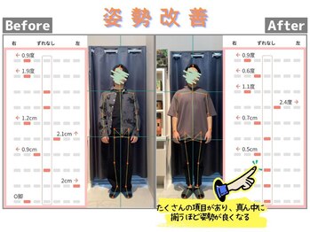 篠丸接骨院/◎姿勢改善◎