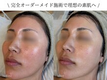 リディエイト(radiate.)