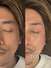 トイヴォ(TOIVO)/自眉毛を活かしたデザインが◎