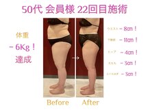 ルミーナ 高崎本店(Lumina)の雰囲気（本格×本気痩身｜見た目が変わる）