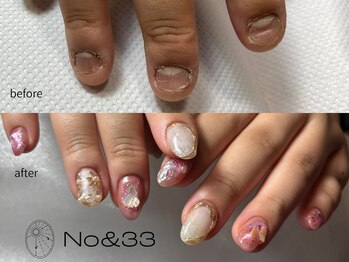 ナンバーアンドスリーサン(No&33)の写真/爪のお悩みコンプレックス解消に!深爪でも自信が持てる指先へ、手元が可愛くなる特別なネイルを