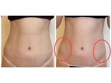 ポノーラ(Ponola)/インドエステ