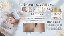 リモアプラス(ReMORE+)
