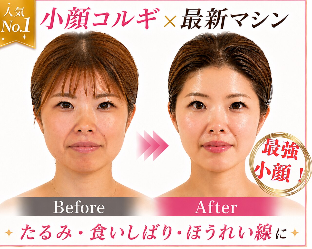 人気No.1【たるみ改善×徹底小顔】コルギ+最新マシン　80分