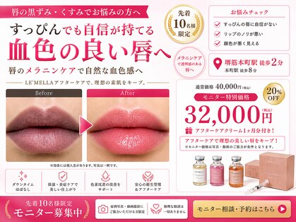 ホワイトニング ハナ 南本町店(WHITENING HANA)の写真