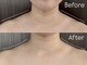 アドネ(Adone)の写真