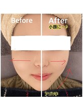 アンドグレイスプラス 恵比寿(&Grace+)/【Before→After】