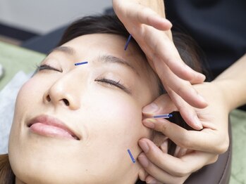 ハリマロの写真/【身体の内側からキレイに整う♪】美容鍼×根本改善整体で小顔・肩こり・眼精疲労のお悩みにアプローチ！