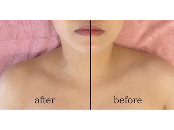 ルヴェール 久屋公園(le verre)/ララピール×筋膜EMS