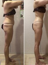 エステティックサロン フェアリー(ESTHETIC SALON FAIRLY)/痩身＊セル脂肪はセルゼロで管理