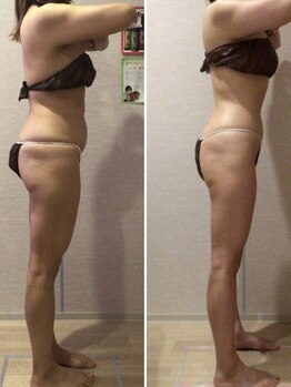 エステティックサロン フェアリー(ESTHETIC SALON FAIRLY)/痩身＊セル脂肪はセルゼロで管理