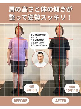 スペックフィジカルコンディショニング(SPECフィジカルコンディショニング)/40代女性/姿勢ビフォーアフター
