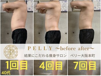 ペリー(PELLY)/男性40代　before after