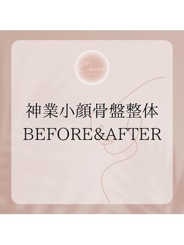 エクシア(Excia)/小顔骨盤整体