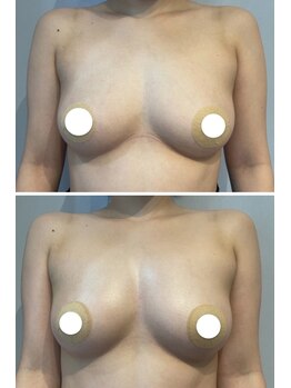 ルナグランデ(Luna grande.)/谷間にボリューム