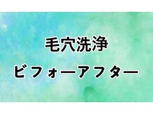 ビエル(Bielle)/開き毛穴つまり黒ずみざらつき