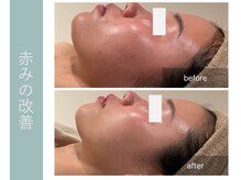 ジョルネ 中目黒(jornee.)/before/after