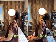 アポヨ鍼灸院(APOYO鍼灸院)/頭痛整体 before/after