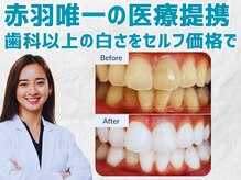 スマイルホワイト 赤羽店