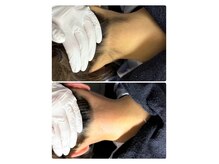 ワックス脱毛でさわり心地の良いすべすべ肌を手に入れて★