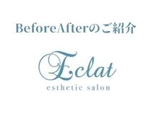 エクラ(Eclat)/当店のBeforeAfterをご紹介！