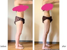 ヨサパーク 新百合ヶ丘店(YOSA PARK)/【before&after】