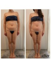 ドリームローズ(Dream Rose)/痩身