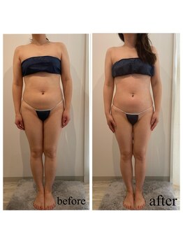 ドリームローズ(Dream Rose)/痩身