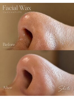 シト(Shito)の写真/フェイシャルWax+毛穴洗浄で毛穴つるん