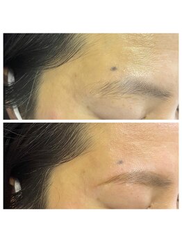 爪屋べっぴん堂/