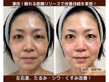 ハンナリ(Hannari)の写真