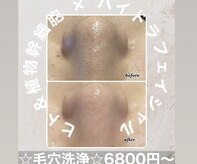 エンチャント(ENCHANT)