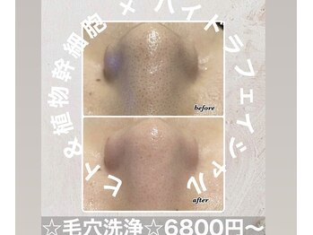 エンチャント(ENCHANT)