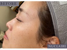 フーフラット(Huu flat)/ヌクレールフェイシャルワックス