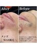 【メンズ限定】ツルツル青髭にならない☆*髭まるごとごっそりフェイスWAX脱毛