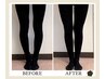 【O脚・X脚による膝の痛みを改善したい方】 整体+O脚X脚美脚矯正　約60分