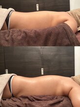 フィール(feel)/Before/After リンパマッサージ