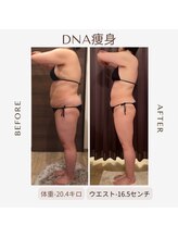 ビーシェイプ 君津(B-Shape)/【痩身】ビフォーアフター