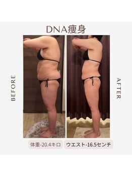 ビーシェイプ 君津(B-Shape)/【痩身】ビフォーアフター