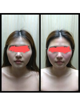 ビューティースリム タニダ/