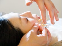 鍼灸接骨院 美と整/美容鍼