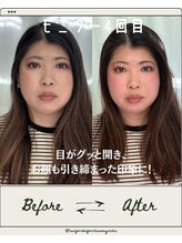 たいよう美容鍼灸院/Before After