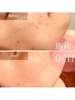 クウラ 学園前店(KUULa)/しっかりケアしていきましょ！！