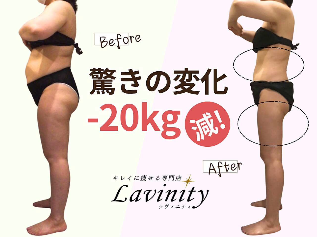 ラヴィニティ 五反田店(Lavinity)｜ホットペッパービューティー