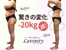 ラヴィニティ 五反田店(Lavinity)